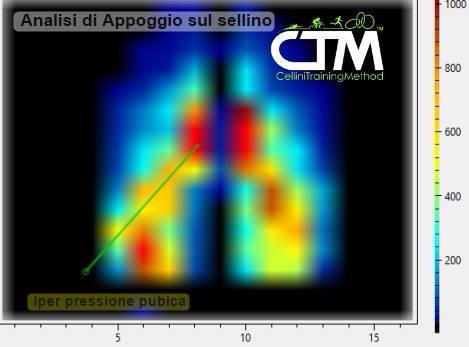 Dolore al perineo uomo